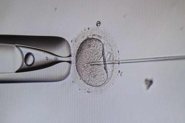 ICSIs-Behandlung in Dänemark bei IVF SYD.